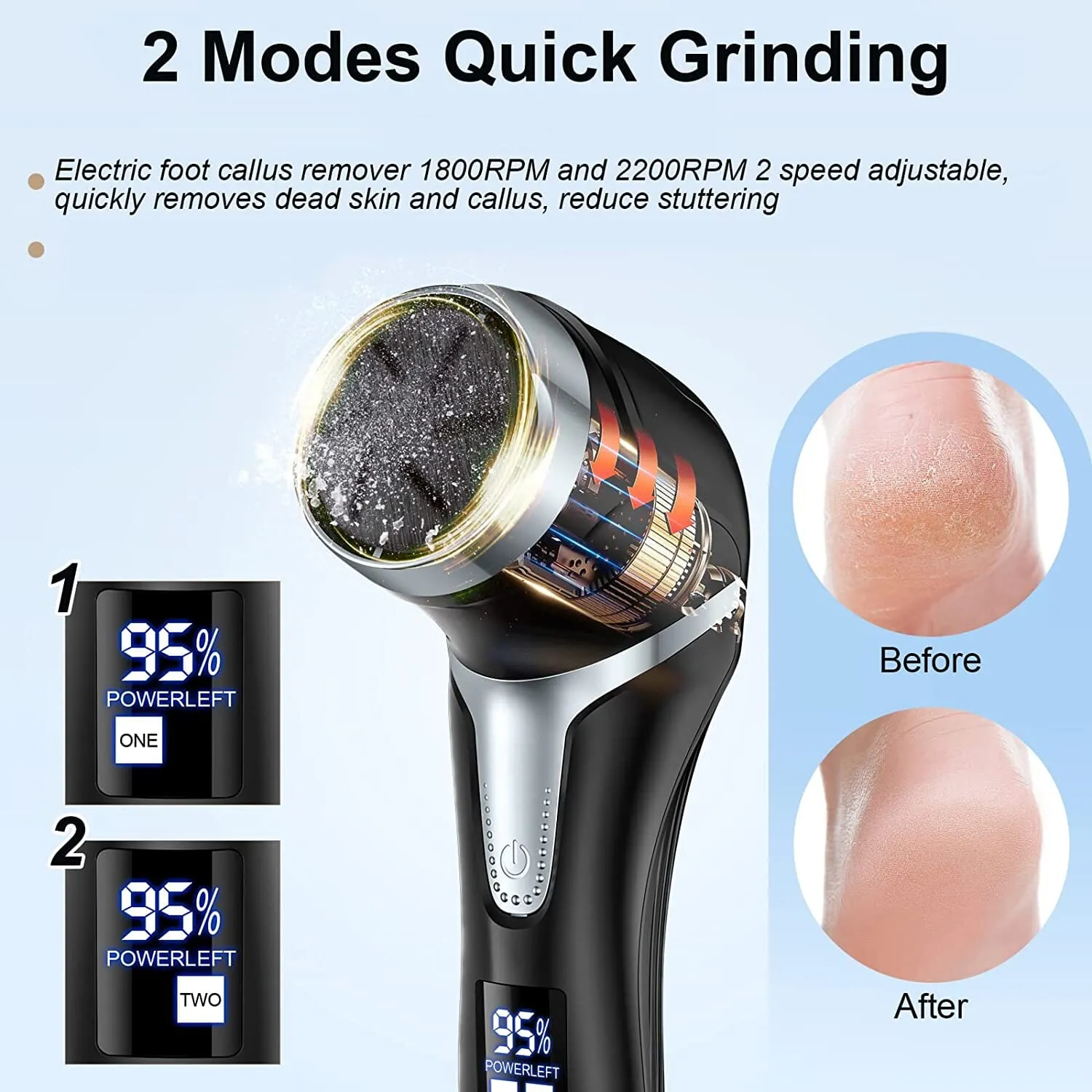 Electric Foot Callus Remover with Vacuum Cleaner